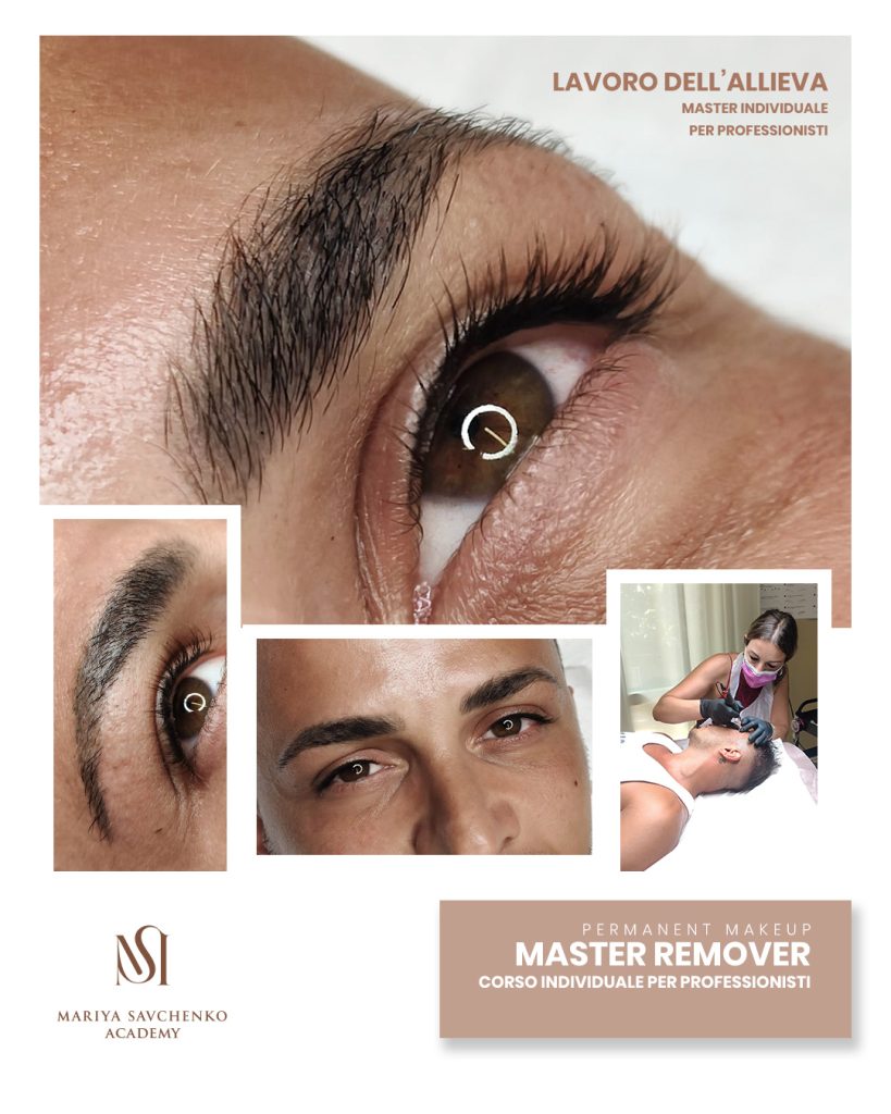 Master rimozione tatuaggio e correzione viraggi nella dermopigmentazione