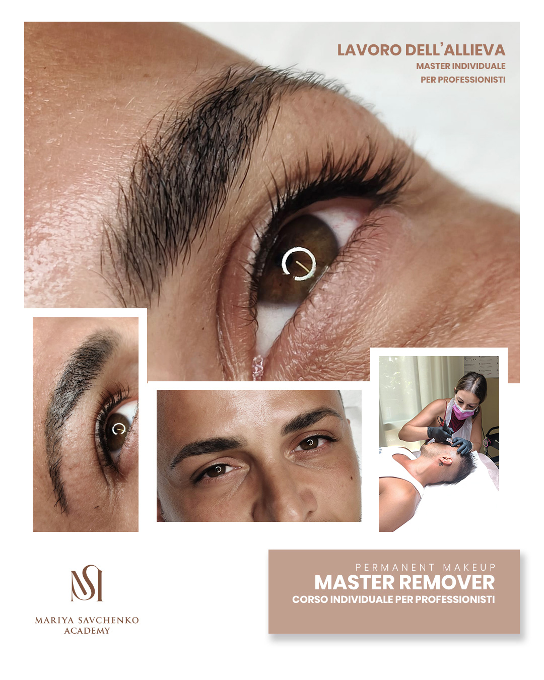 Master rimozione tatuaggio e correzione viraggi nella dermopigmentazione